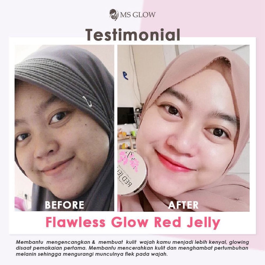 MS Glow Flawless Red Jelly Original Pelembab Kulit Mencerahkan Wajah Menyamarkan Bekas Jerawat Kemasan Terbaru-5