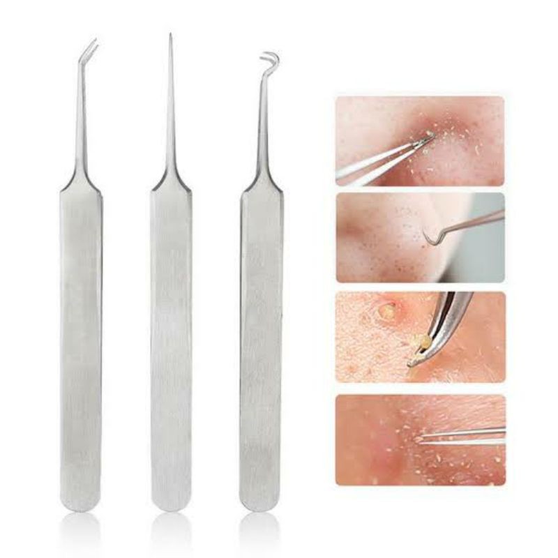 PINSET PENJEPIT PENCABUT KOMEDO JERAWAT / BLACKHEAD ACNE TWEEZER