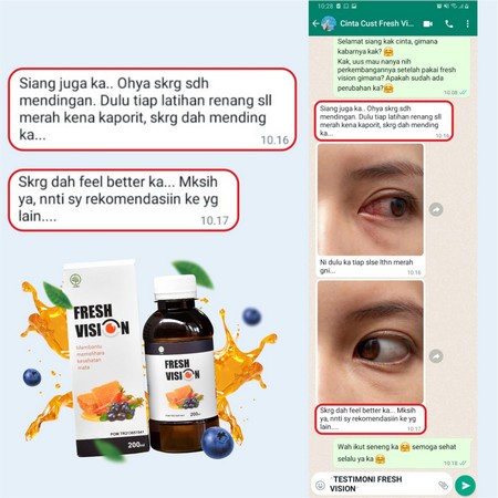 Fresh Vision Asli - Madu Suplemen Atasi Masalah Kesehatan Mata Perih Kering Glukoma Glaukoma Katarak Kurangi Mata Minus Mines Pandangan Buram Kabur