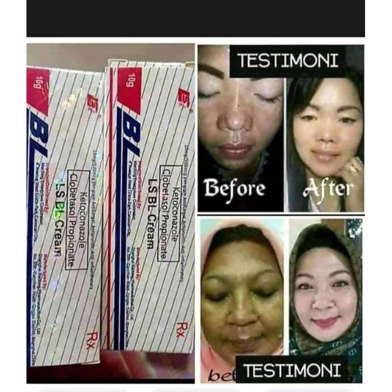 Cream bl original / Salep bl kemasan tube 10gram asli 100% / Cream bl / Salep bl