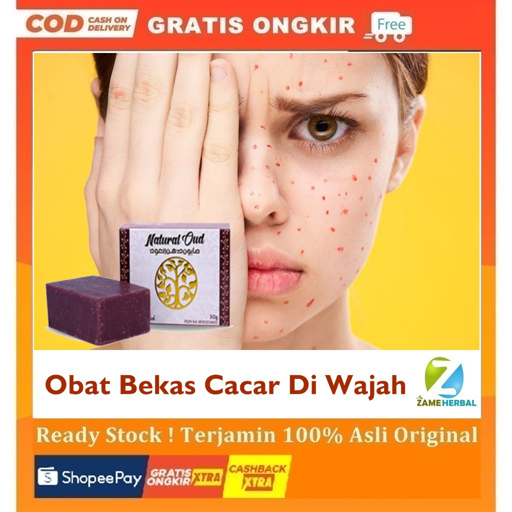 Jual Obat Bekas Cacar Di Wajah Obat Rosacea Obat Psoriasis Obat