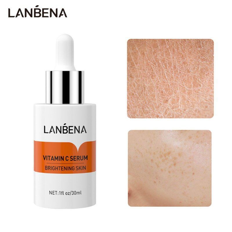 LANBENA Vitamin C Serum Essence 30mL - Whitening Mencerahkan Wajah Lighten Spots Fade Dark Spots Anti Aging Perawatan kulit (30ml)