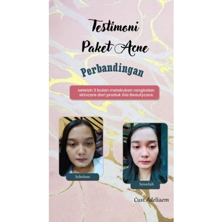 Paket Pemutih Farmasi || Gia Beautycare