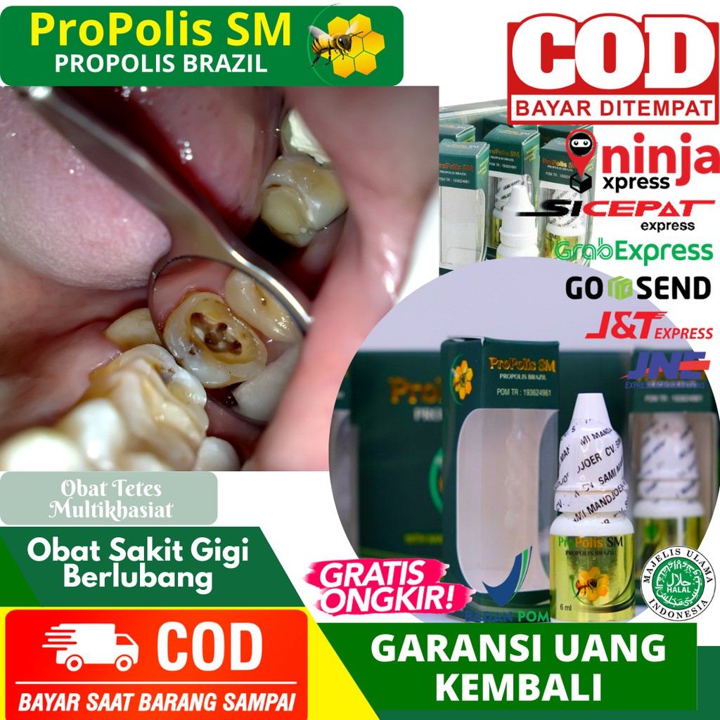 Obat Sakit Gigi Berlubang, Sakit Gigi, Penghancur Gigi Berlubang, Gusi Bengkak, Propolis SM Aman COD