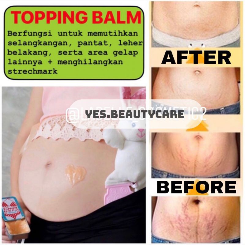 TOPPING BALM PLUS ORIGINAL THAILAND PEMUTIH SELANGKANGAN BOKONG KETIAK PANTAT LEHER BY LITTLE BABY TOPING BPOM