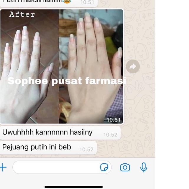 Grand Seller|SQ40|BIBIT PEMUTIH GRADE A + LOTION DERMOVATE 250 ML