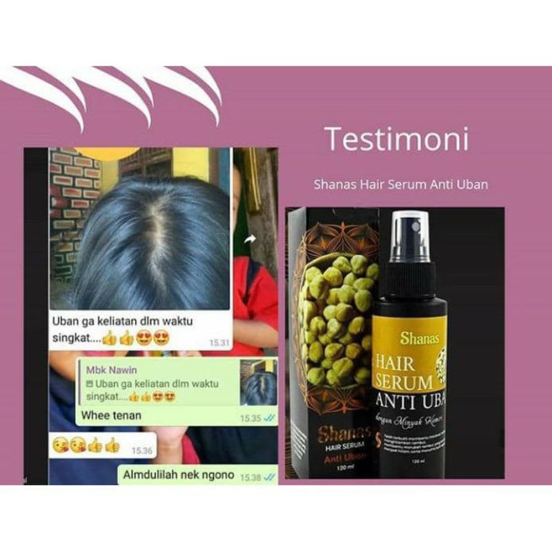 SERUM ANTI UBAN SHANAS HERBAL ALAMI