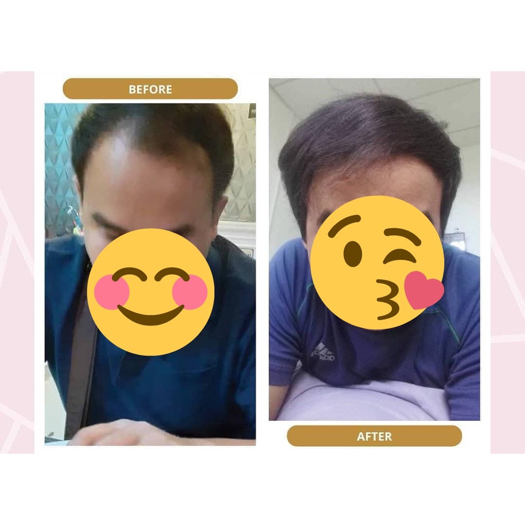 BIO HERBAL GINSENG PAKET SHAMPOO - HAIR TONIC - PENUMBUH RAMBUT BOTAK - TONIC RAMBUT PENUMBUH RAMBUT