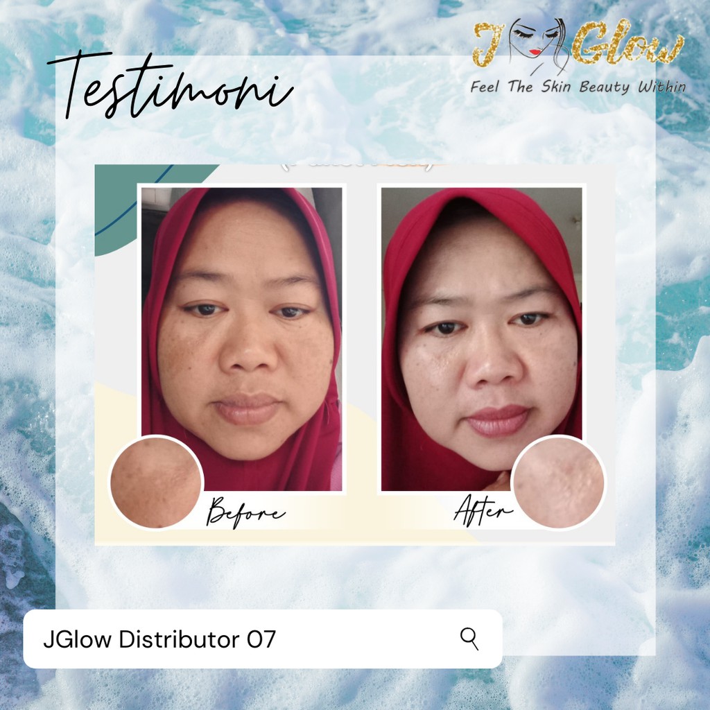 JGLOW Flek Melasma Hyperpigmentasi | Paket Perawatan Wajah Skincare BPOM-4