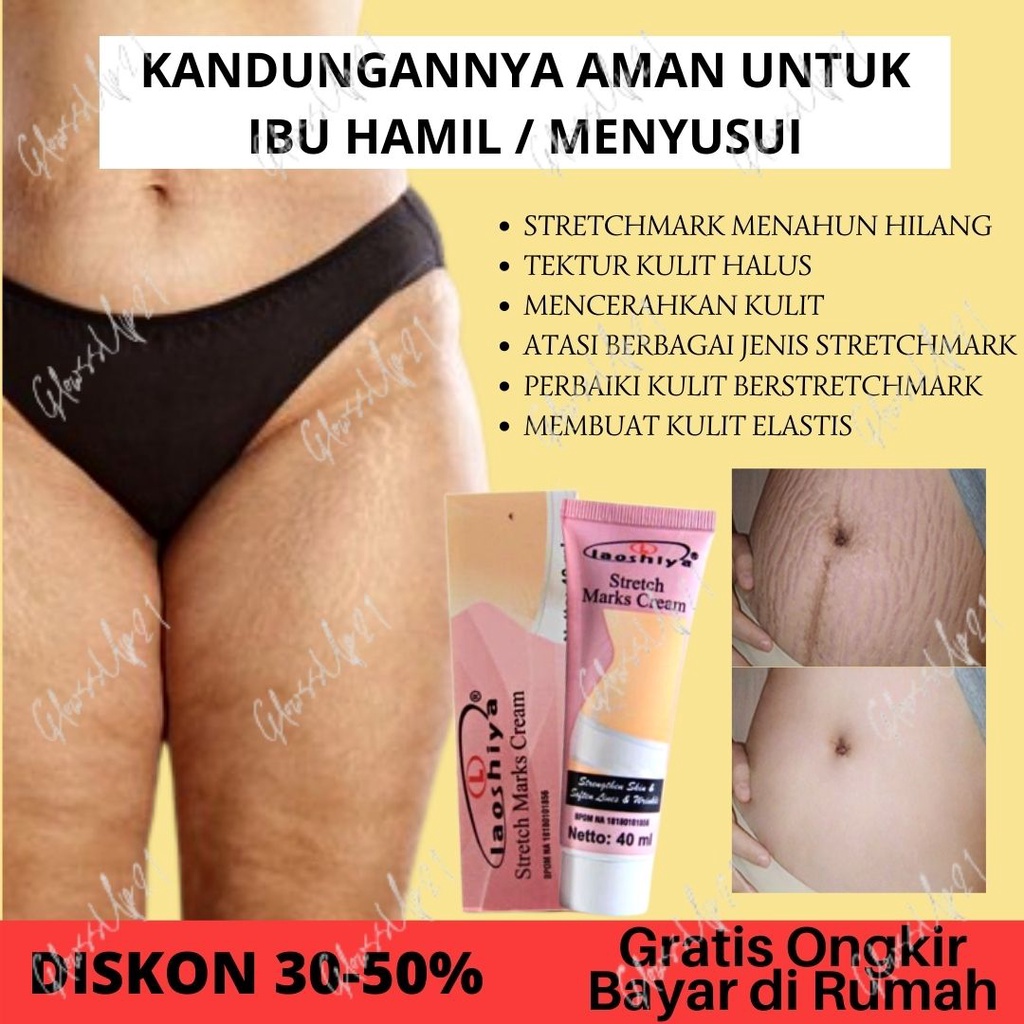 LAOSHIYA STRETCH MARKS CREAM ORIGINAL BPOM - STRETCH MARKS LAOSHIYA