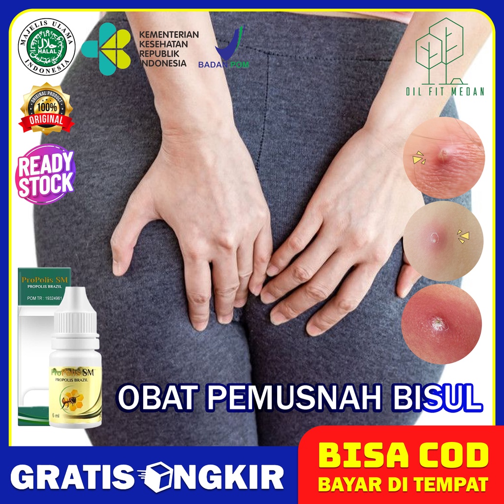 Obat Bisul di Pantat Benjolan di Pantat Jerawat Pantat Jerawat Bokong Gatal Pantat Propolis Sm