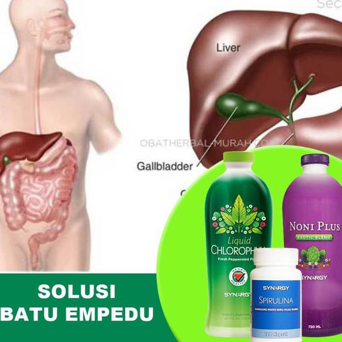 Paket Herbal Obati Batu Empedu Plus Suplemen Kekebalan Tubuh Dewasa TERLARIS