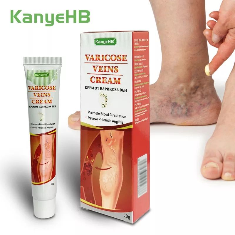 Obat Salep Krim VARISES / PARISES / FARISES / PARISES Di Kaki Dan Betis Tangan Paling Ampuh VARIKOKEL