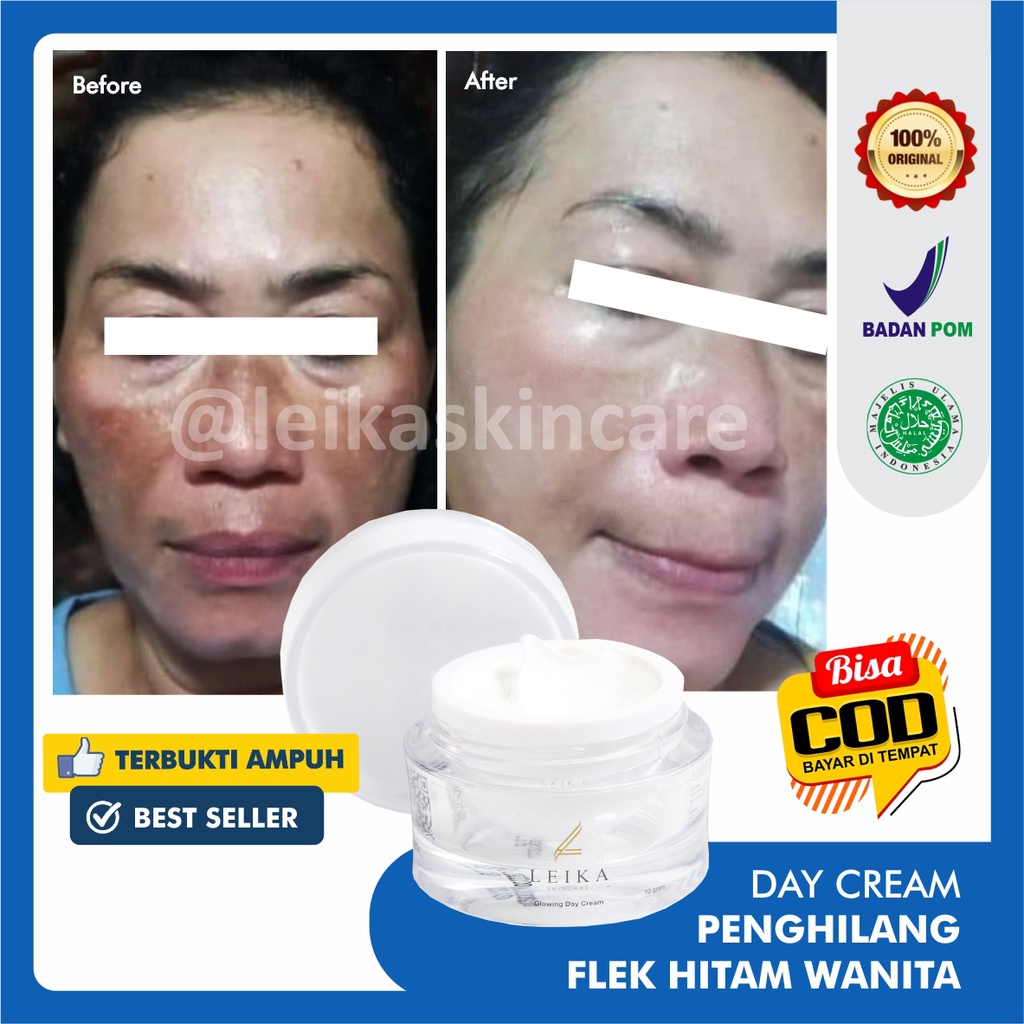 Cream Bagus! Penghilang Flek Hitam Cream Penghilang Flek Hitam Membandel Krim Penghilang Flek Hitam BPOM Halal MUI Ampuh Aman Salep Flek Hitam Glowing Day Cream Leika Skincare Salep Flek Hitam Membandel Paling Ampuh Crem Penghilang Flek Hitam