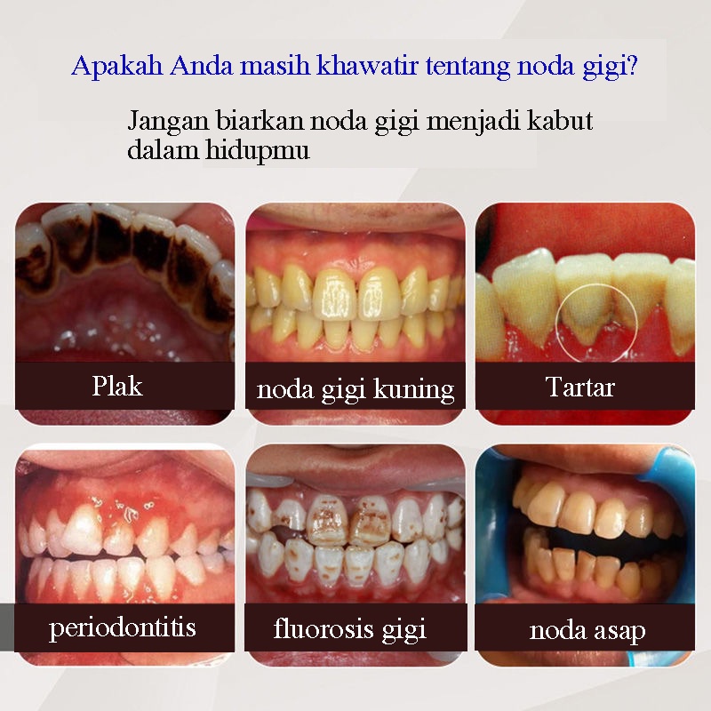 pemutih gigi permanen permanen penghilang karang gigi 30ml Perawatan Mulut Menghilangkan plak dan noda asap Menghilangkan bau mulut