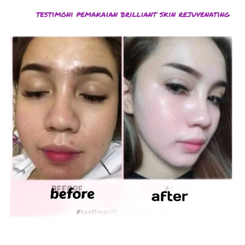 BRILLIANT skincare rejuvenating 4in1 original philipina termurah terlaris