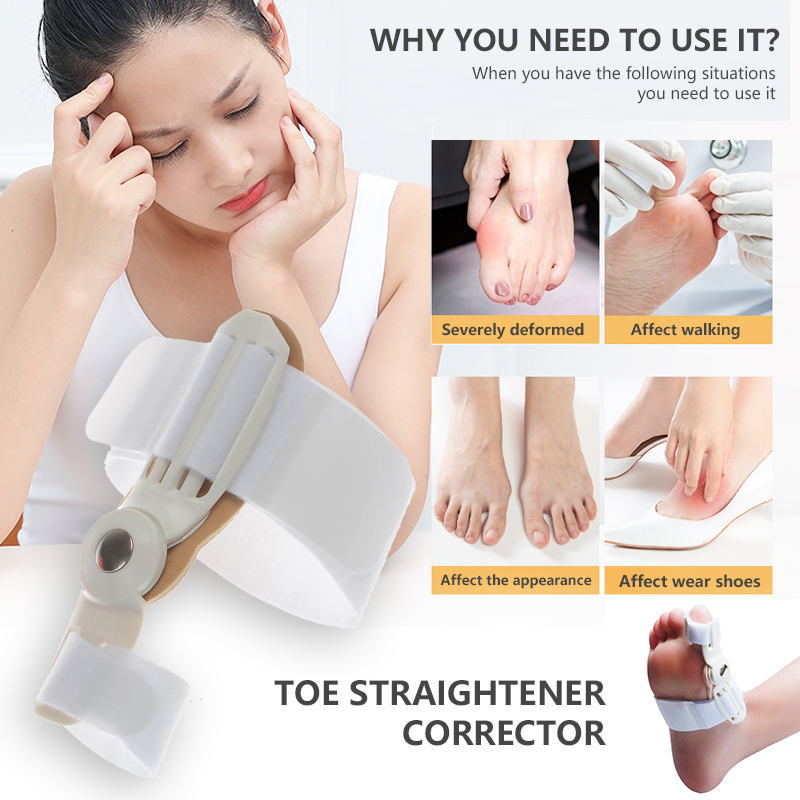 Big Bone Toe Bunion Splint Toe Straightener Corrector Koreksi Hallux Valgus Perlengkapan Ortopedi