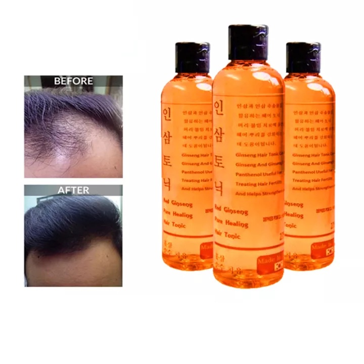 HOPE STORE - Red Ginseng Korea HAIR TONIC ORIGINAL Penumbuh Rambut Botak dan Pelebat Rambut