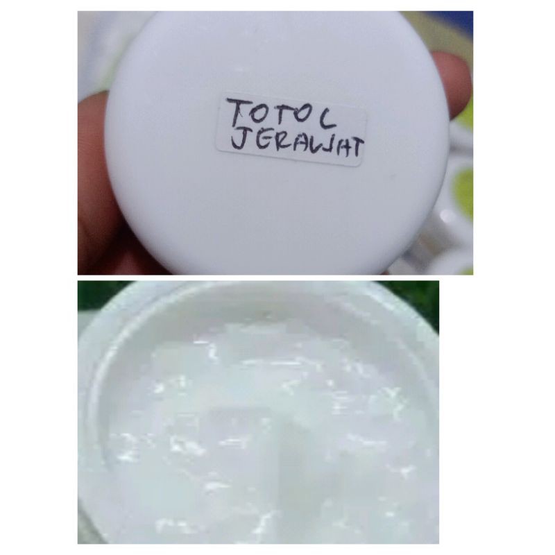 

Totol jerawat