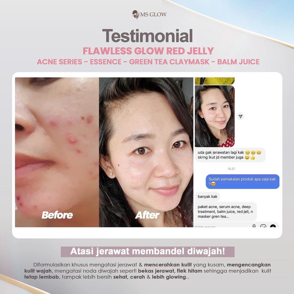 MS Glow Flawless Red Jelly Original Pelembab Kulit Mencerahkan Wajah Menyamarkan Bekas Jerawat Kemasan Terbaru-6