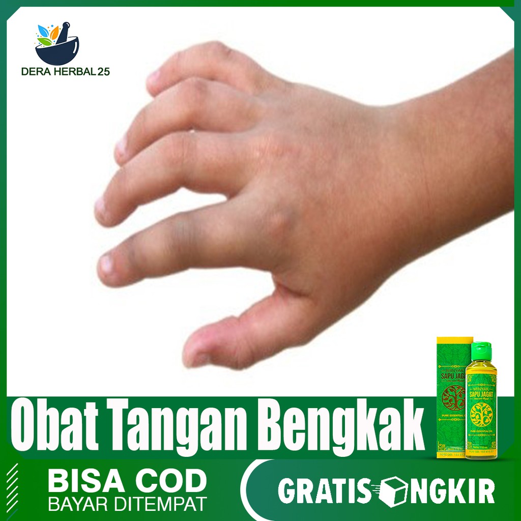 Jual Minyak Herbal Balur Untuk Tangan Bengkak Kaki Bengkak Minyak Sapu Jagat 100 Original Indonesia Shopee Indonesia