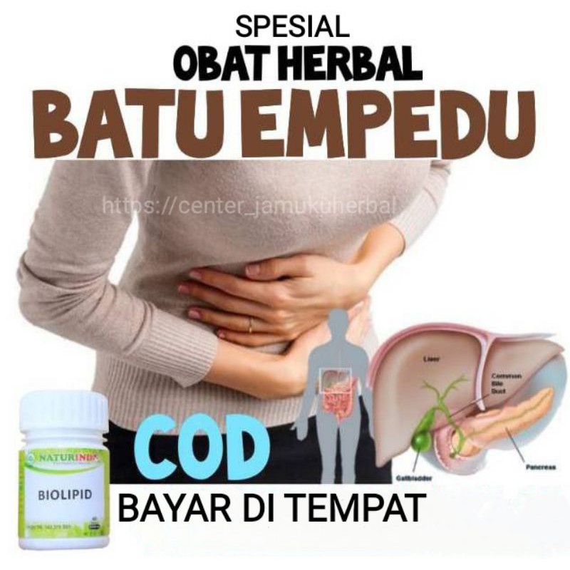 COD Obat Herbal Penyakit Batu Empedu.Obat Cairan Empedu Naturindo Fresh