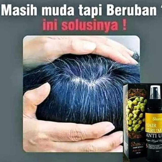 Serum anti uban/shanas serum anti uban/atasi uban/herbal mencegah uban