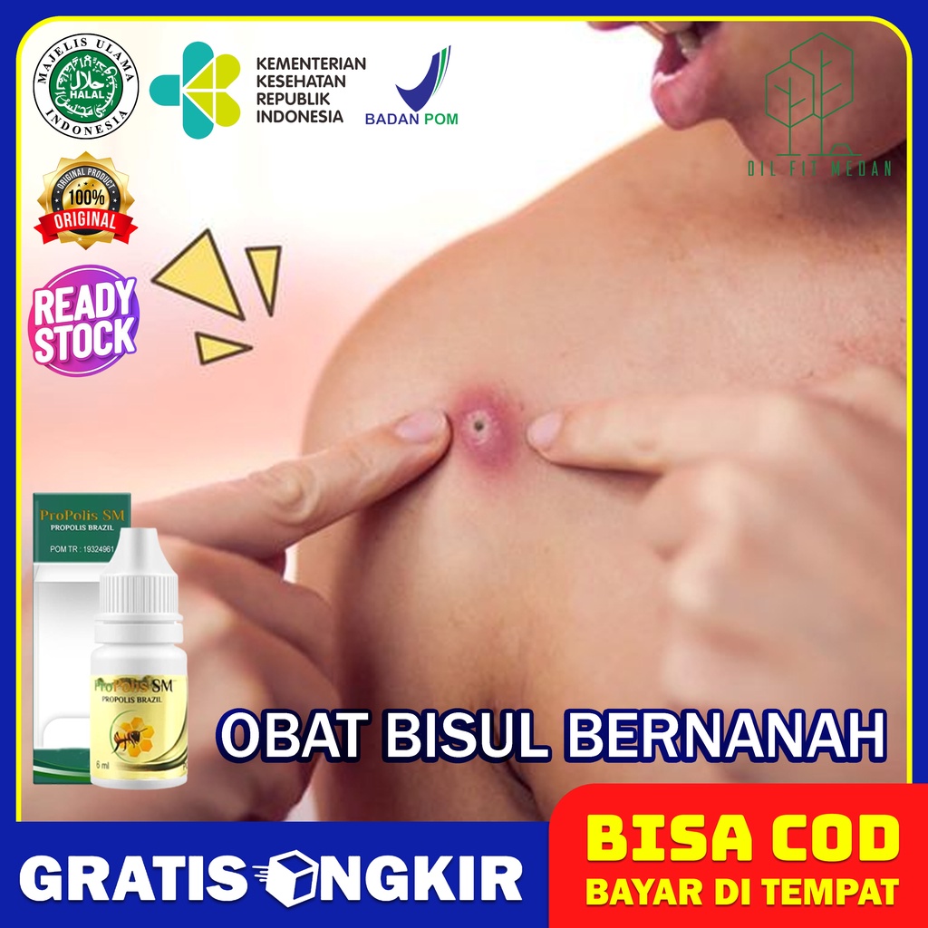 Obat Bisul Bernanah Udun Menahun Bisul Anak Dan Dewasa Udun di Pantat Herbal Propolis Sm Brazil Asli