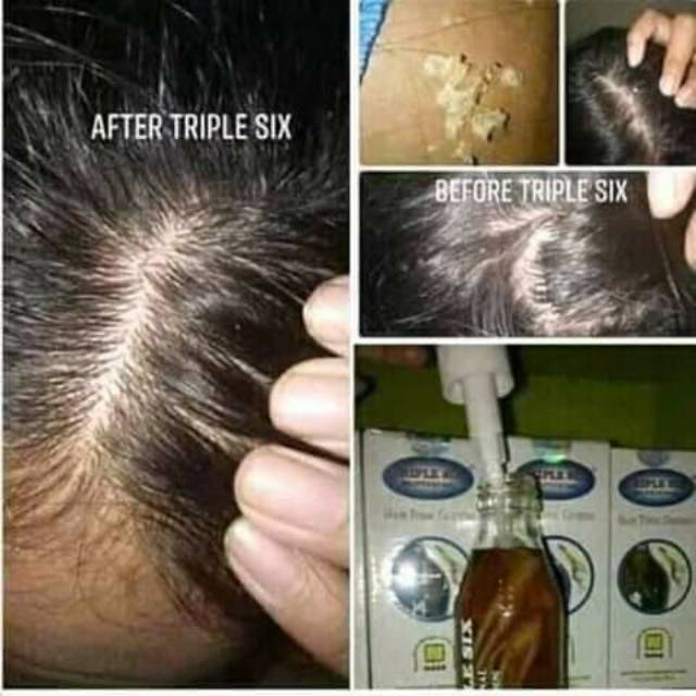 TRIPLE SIX HAIR TONIC NASA