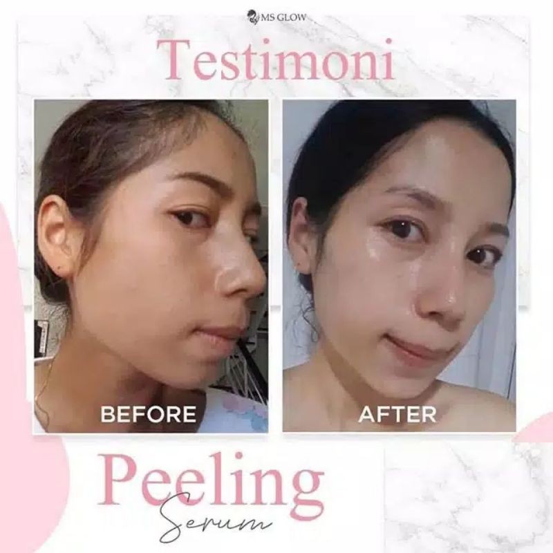 Peeling Serum MS Glow Original mengangkat sel kulit mati skincare (bisa cod)