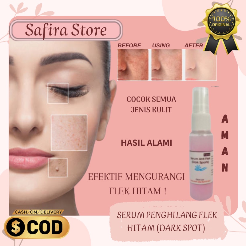 Jual Serum Penghilang Untuk Menghilangkan Flek Hitam Dark Spot Melasma ...