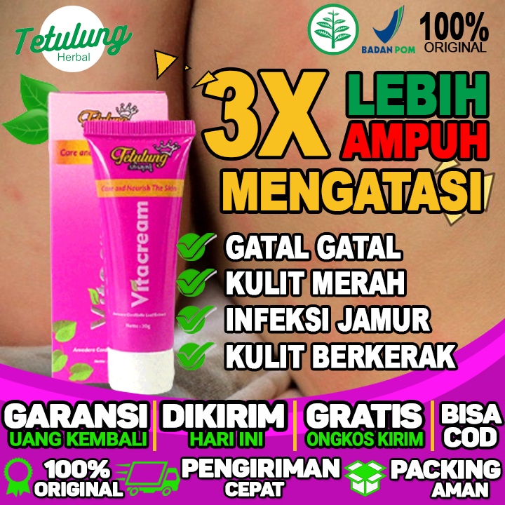 Obat Gatal Kulit Paling Ampuh Obat Gatal Selangkangan Eksim Dan Jamur Paling Ampuh