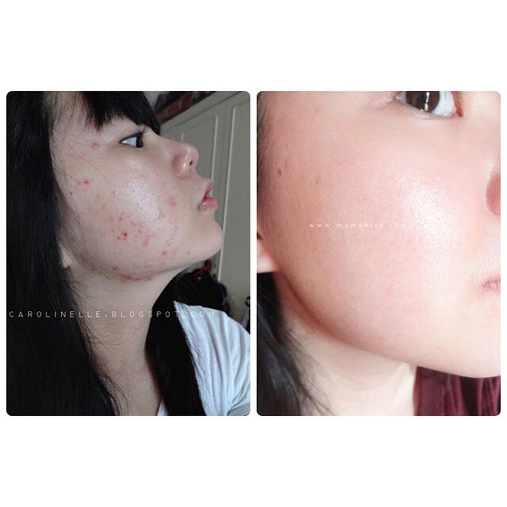 Albion Skincare Sharing Set B
(Exage Milk White/Moist 15ml + Skin Conditioner 30ml)