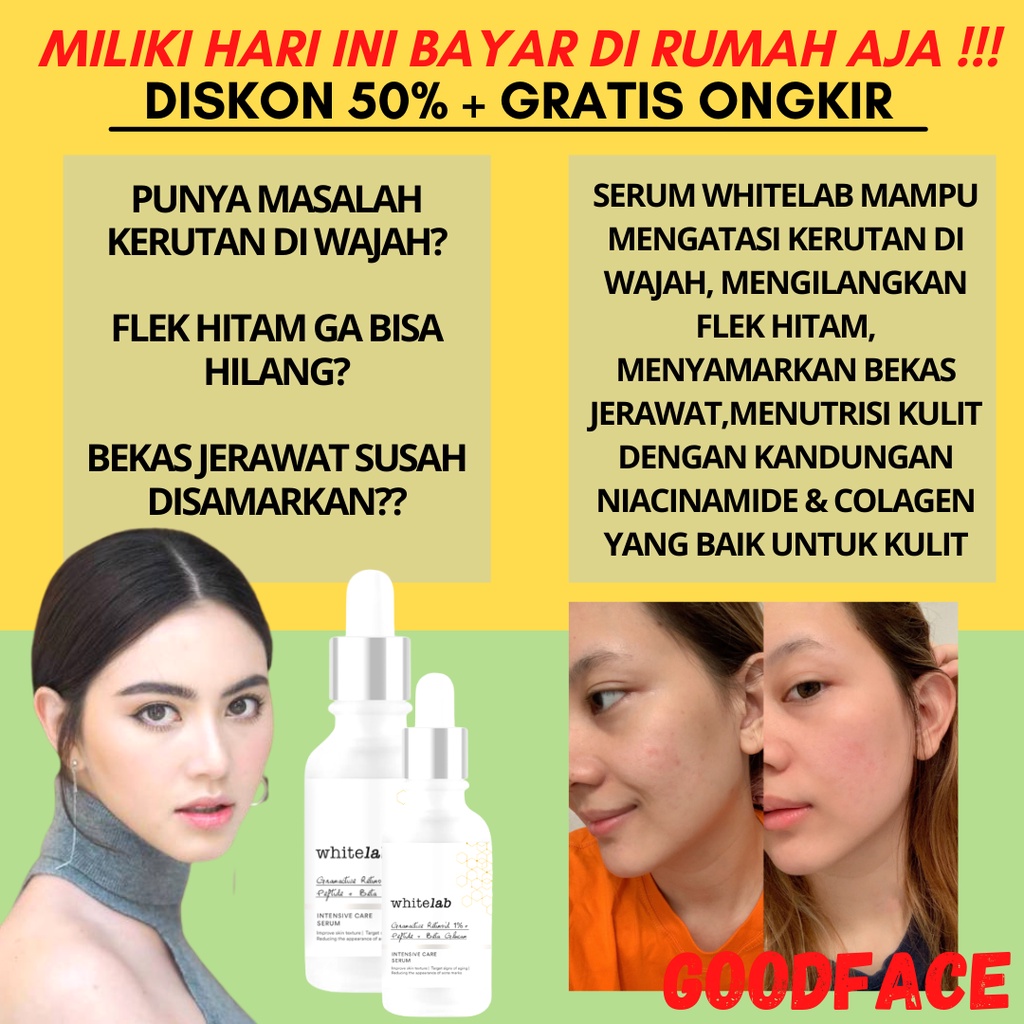 SERUM PEMUTIH PECERAH WAJAH WHITELAB INTENSE BRIGHTENING SERUM - NIACINAMIDE 10% PERAWATAN WAJAH