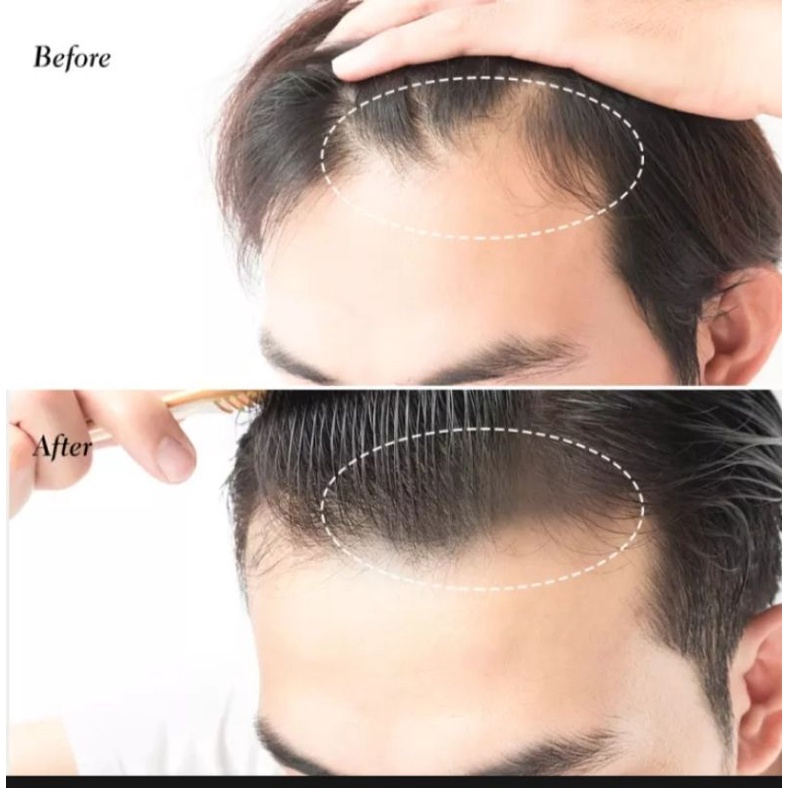 Hair shadow bedak rambut Sevich/ Maycheer solusi untuk menutupi rambut tipis/ botak