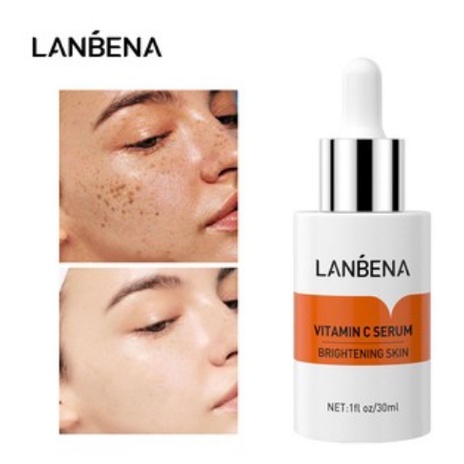 LANBENA Vitamin C Serum Brightening Skin - Mencerahkan Wajah (30ml)