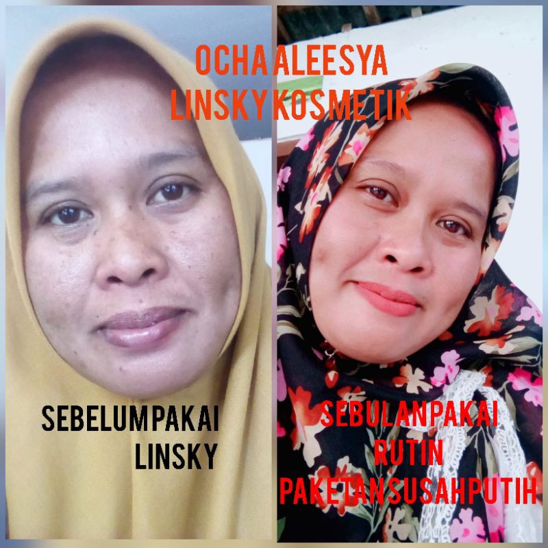 

LINSKY