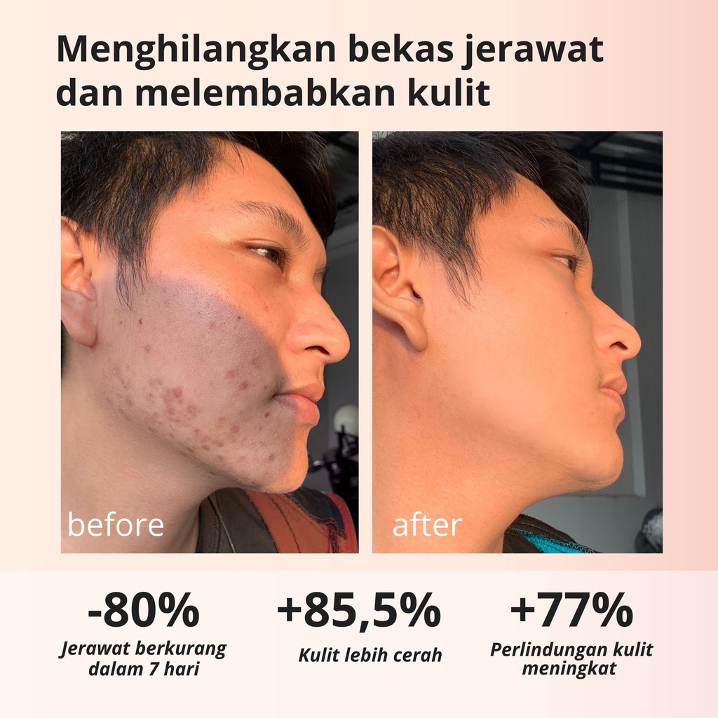 Lauralee Salmon DNA Sabun Wajah & Tubuh Pemutih 2in1 1 Box isi 2pcs Bright & Acne-5