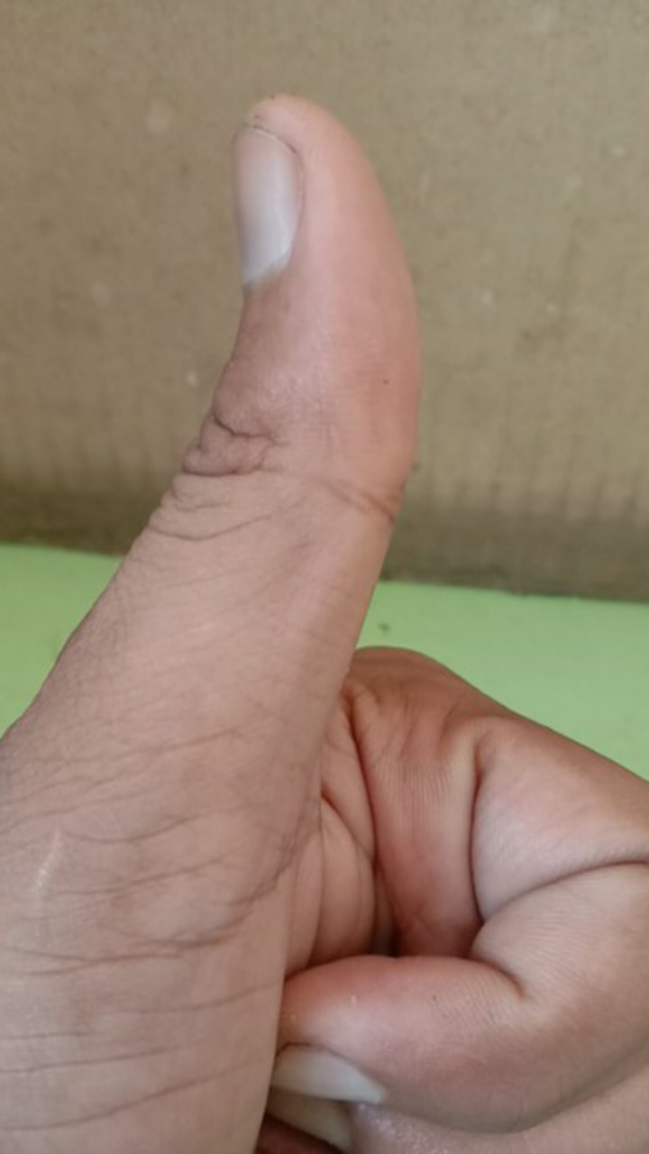 Bahan Akar Bahar Merah (24-29) Cm