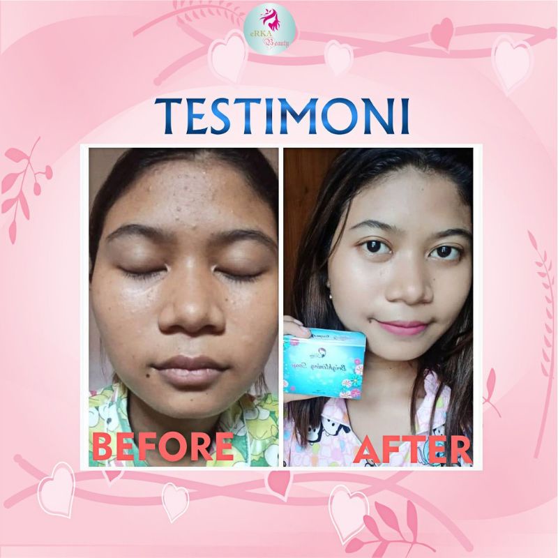 Sabun*pemutih*wajah*dan*badan*Pria*Wanita*Permanen*BPOM*Brightening*