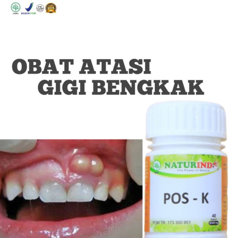 Obat Herbal Gusi BengkakTerampuh Obat Gusi Berdarah Terlaris