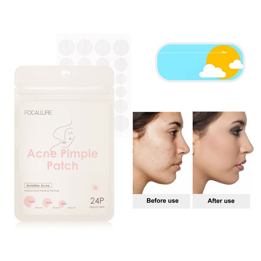 FOCALLURE Spot Patch Acne Treatment Day/Night