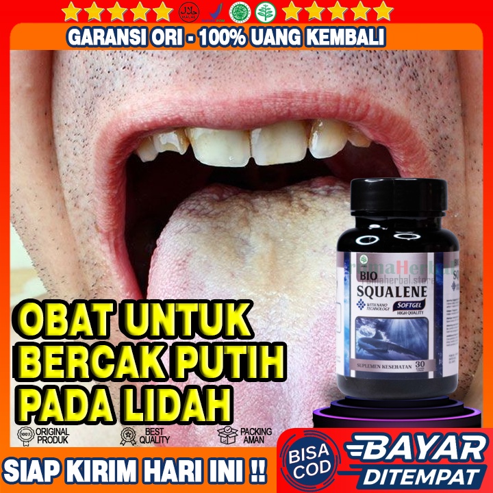 Obat Lidah Bercak Putih - Obat Lidah Pecah Pecah - Obat Lidah Sariawan - Obat Kanker Lidah - Obat Mu