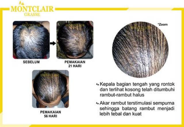 ORIGINAL/Montclair Hair Serum/Penumbuh Rambut Bergaransi-4
