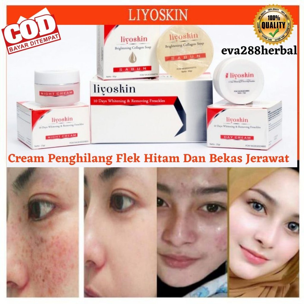 Paket Liyoskin Cream Normal - Obat Pemutih Wajah - Obat Pencerah wajah - Obat Penghilang Flek Hitam