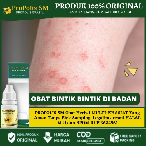 Jual Obat Menghilangkan Bintik Bintik Di Badan Obat Merah Pada Kulit