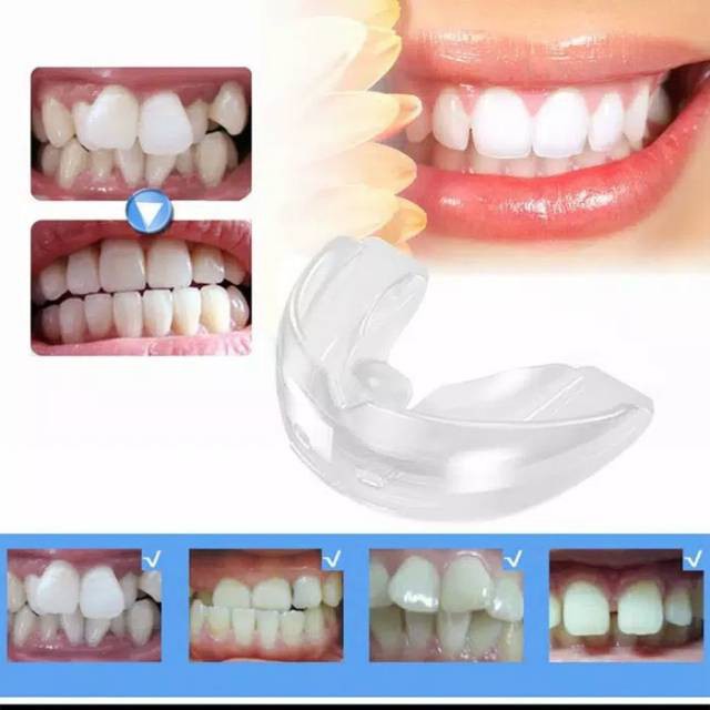 COD-Perapih Gigi Original ISmile USA Perapi Pemutih Gigi Ori Pengganti Behel Gigi/Kawat Gigi