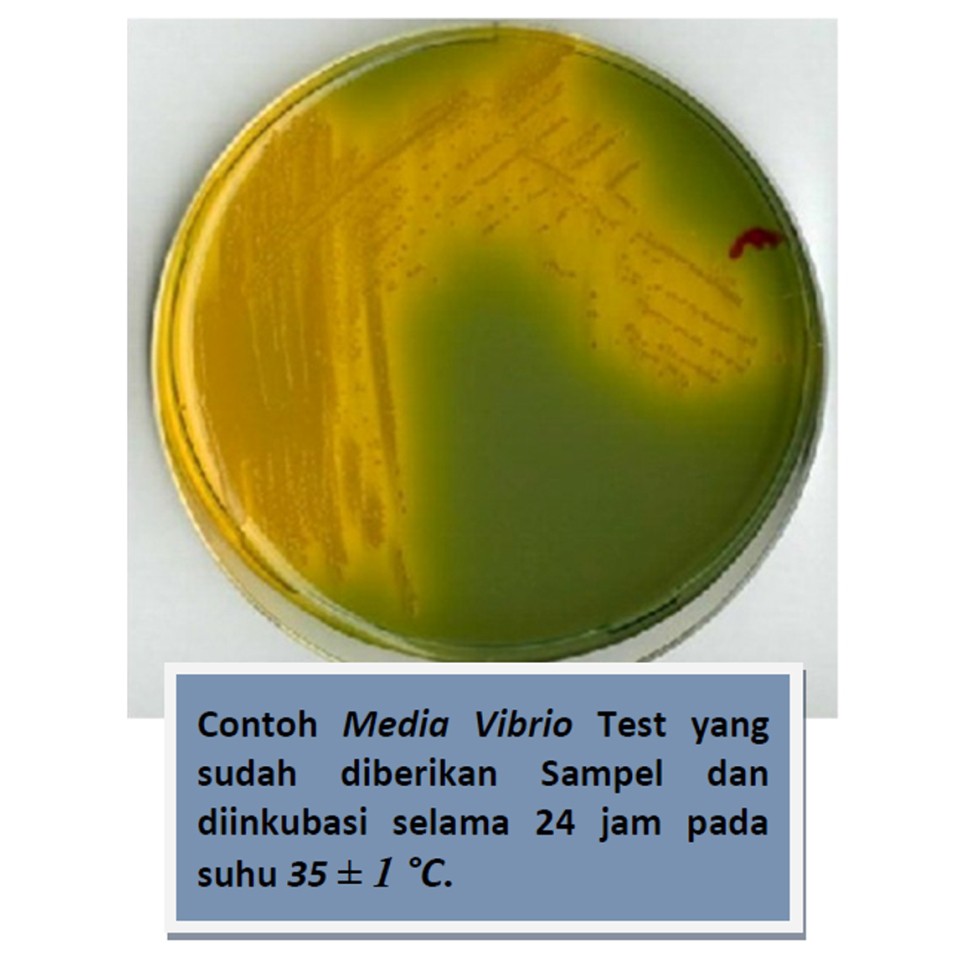 Media Deteksi Vibrio - Deteksi Vibrio - Bacteriologi Test