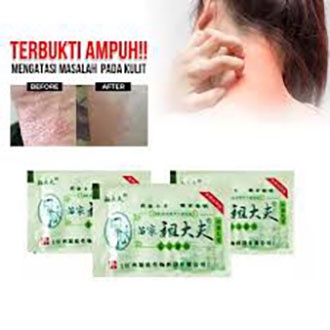 SALEP KULIT EKSIM ZUDAIFU ASLI 100% AMPUH OBATI ALERGI GATAL SELANGKANGAN JAMURAN KUDIS KUTU AIR