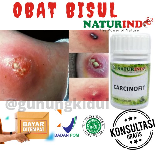 OBAT HERBAL BENJOLAN KANKER TUMOR BISUL JERAWAT BATU LIPOMA UCI UCI HERBAL CARCINOFIT NATURINDO COD-2
